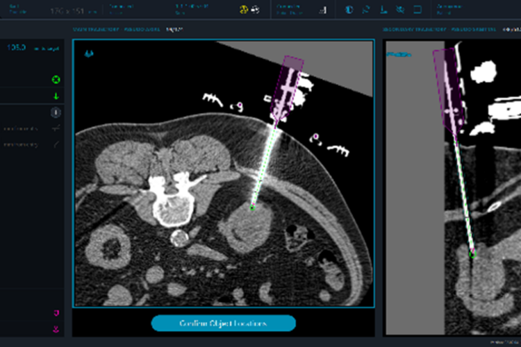 Medical Robotics Technology - XACT Robotics