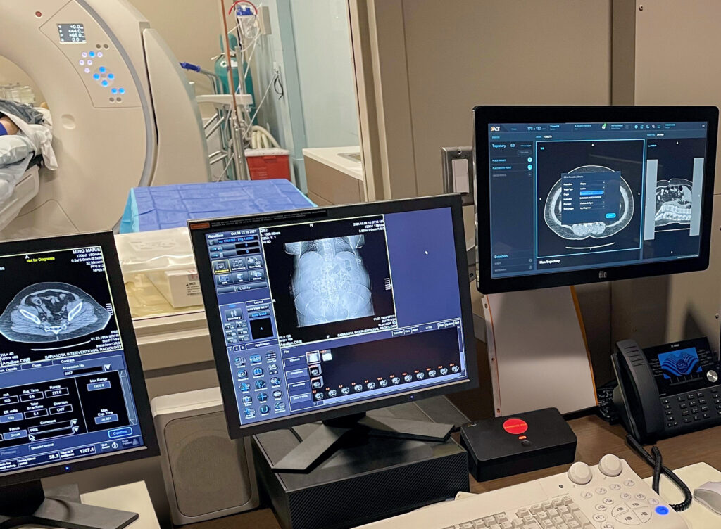 XACT Robotics® Receives FDA Clearance for its ACE Xtend™ Remote Control